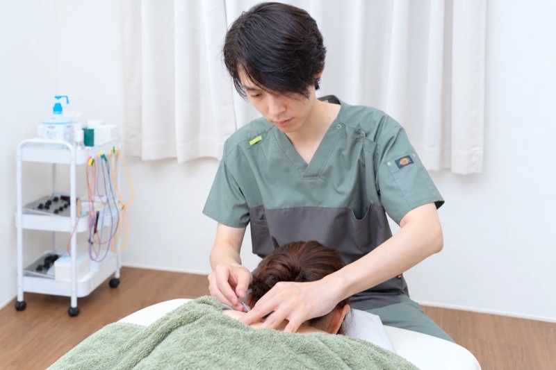 首すじへの鍼によるアプローチ